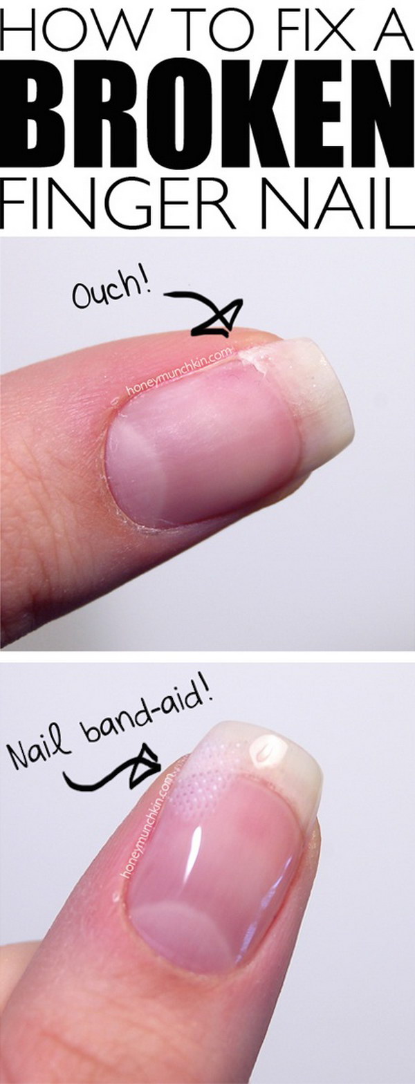 How to Fix a Broken Finger Nail. 